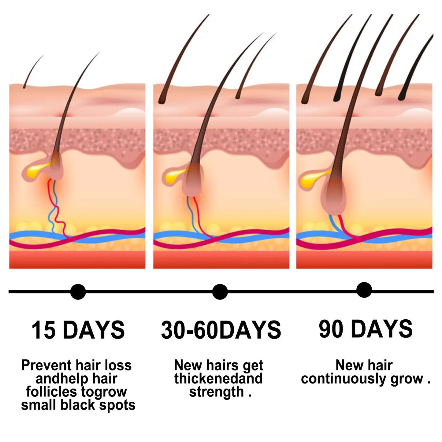 Ginger Repair Hair Follicle Soft Moisturizing And Nourishing Essential Oil 30ml Louisiana Mart