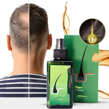 Anti-hair loss, Removing Dandruff, Repairing And Nourishing Shampoo 120ml Louisiana Mart