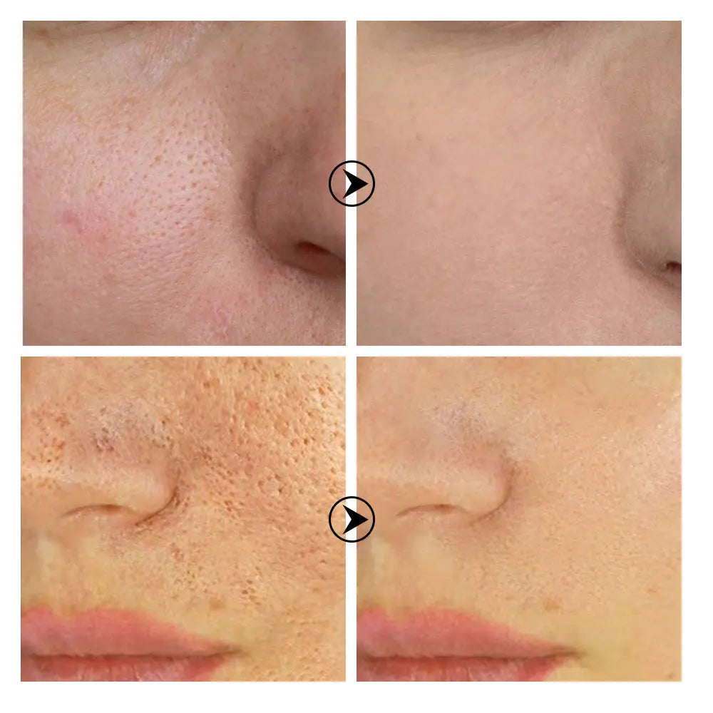 Tea tree pore shrinking serum Louisiana Mart
