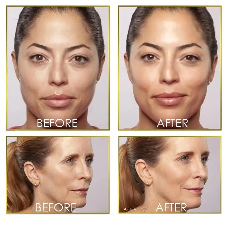 Flawless dermaplane glo hair remover Louisiana Mart