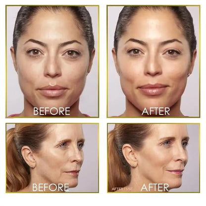 Flawless dermaplane glo hair remover Louisiana Mart