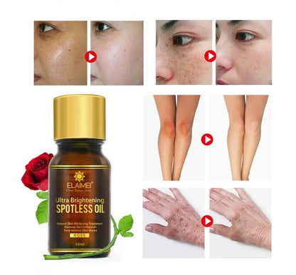 Ultra Brightening Spotless Oil 10ml-Improve dark spots & hyper-pigmentation Louisiana Mart