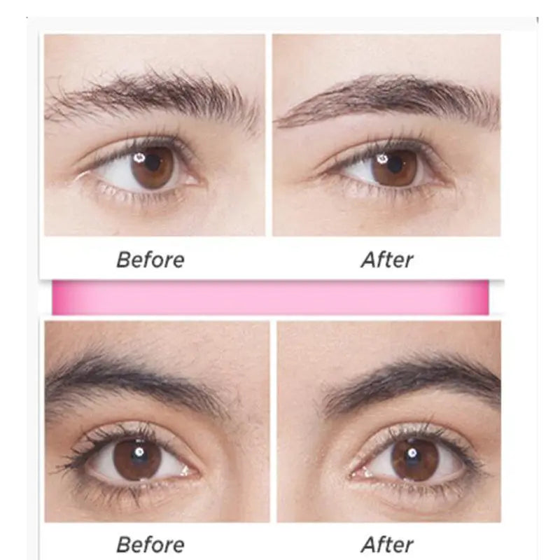 Dermatologist approved Flawlessly Brows Electric Eyebrow Remover Louisiana Mart