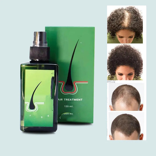 Anti-hair loss, Removing Dandruff, Repairing And Nourishing Shampoo 120ml Louisiana Mart