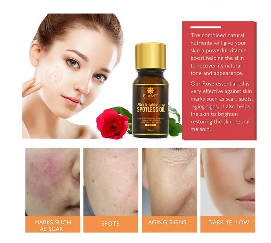 Ultra Brightening Spotless Oil 10ml-Improve dark spots & hyper-pigmentation Louisiana Mart