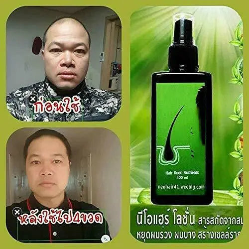 Anti-hair loss, Removing Dandruff, Repairing And Nourishing Shampoo 120ml Louisiana Mart